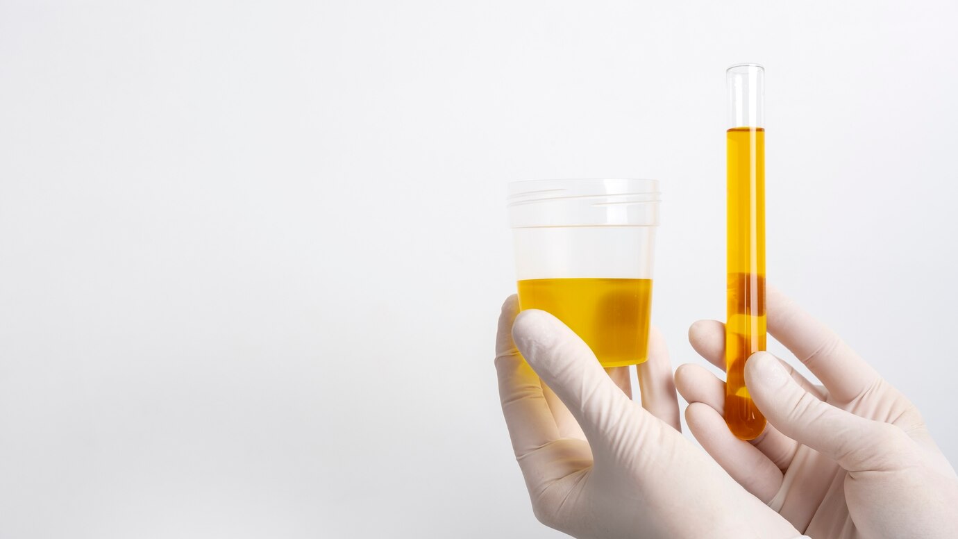 Urine Drug