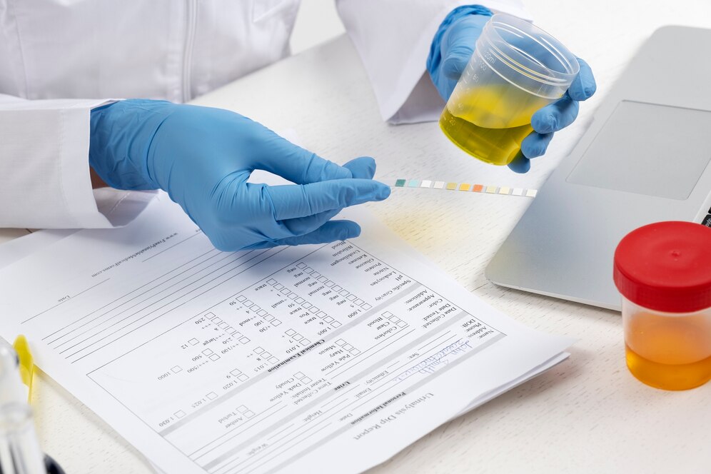 Drug Test: What It Is, Purpose, Procedure & Types