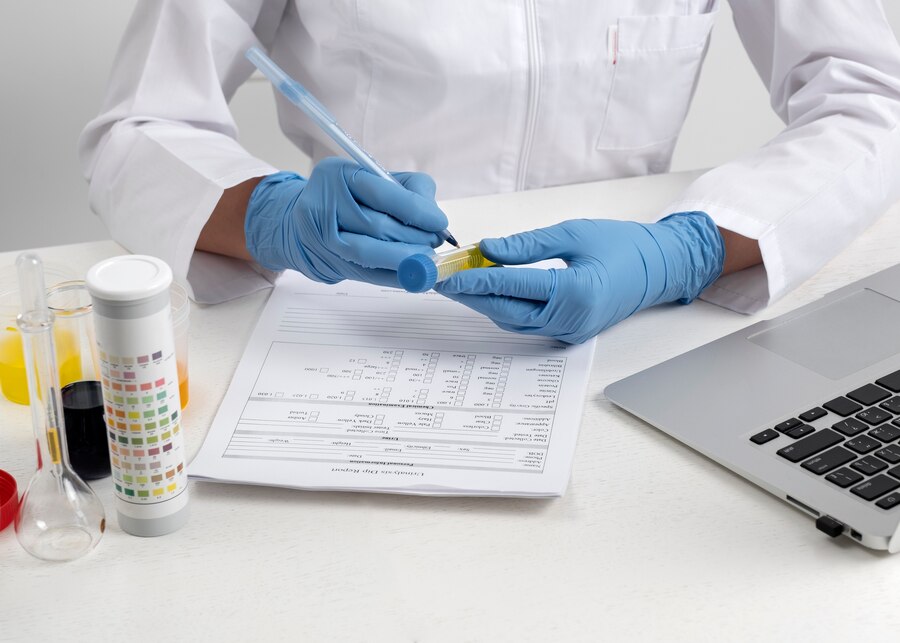 Can a TB Test Detect Latent Tuberculosis?