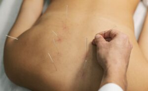 Does Urgent Care Do Stitches Removal?