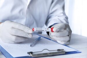 Can you work with a positive TB test