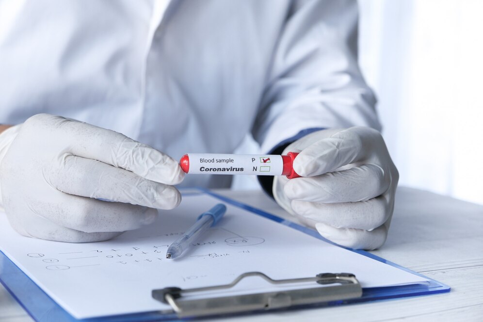 Can you work with a positive TB test