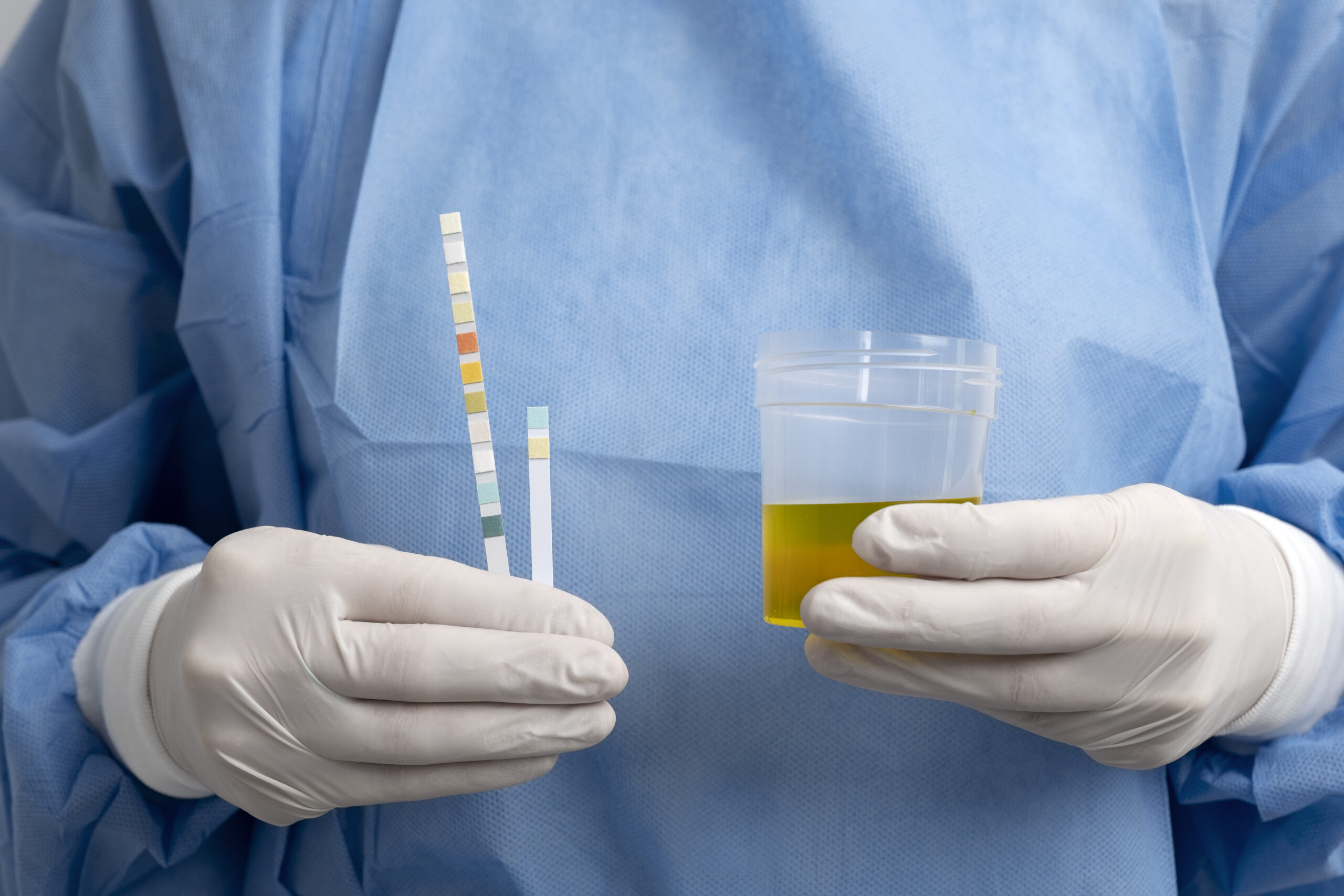 Urine Drug Test