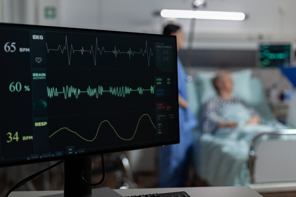 Electrocardiogram Test: What It Is and Why It’s Done