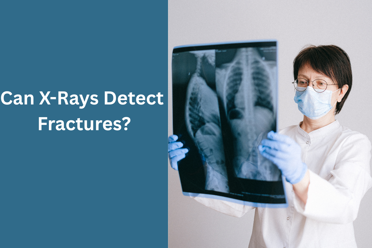 Can X-Rays Detect Fractures