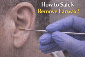 How to Safely Remove Earwax?
